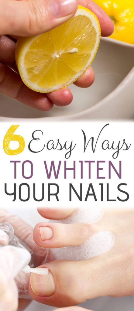 Six Of The Best Tricks To Whiten Your Nails That Actually Work – LazyTries